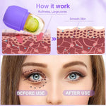 Ice Balls Face Massager